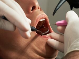 Ist Amalgam schädlich Was Quecksilber im Körper wirklich anrichtet
